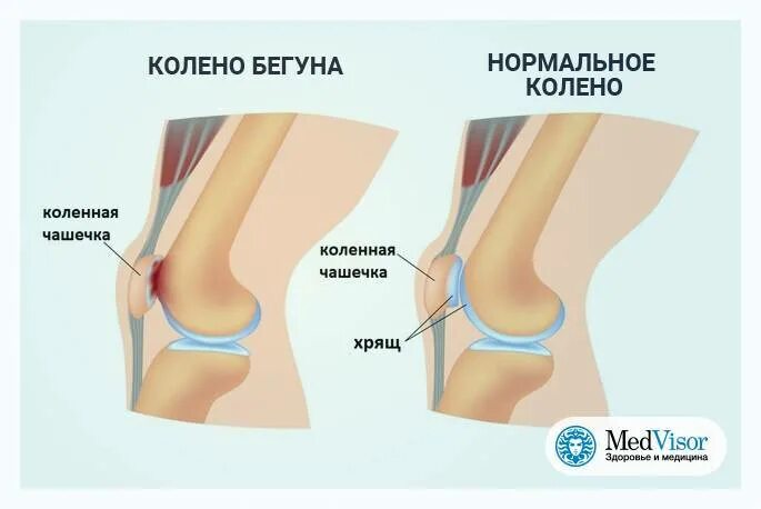 Колено им казалось что