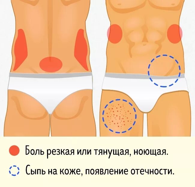 Если болит живот к какому врачу обращаться. Боли в области живота. Животик болит. Болит нижняя часть живота. Низ живота у женщин.