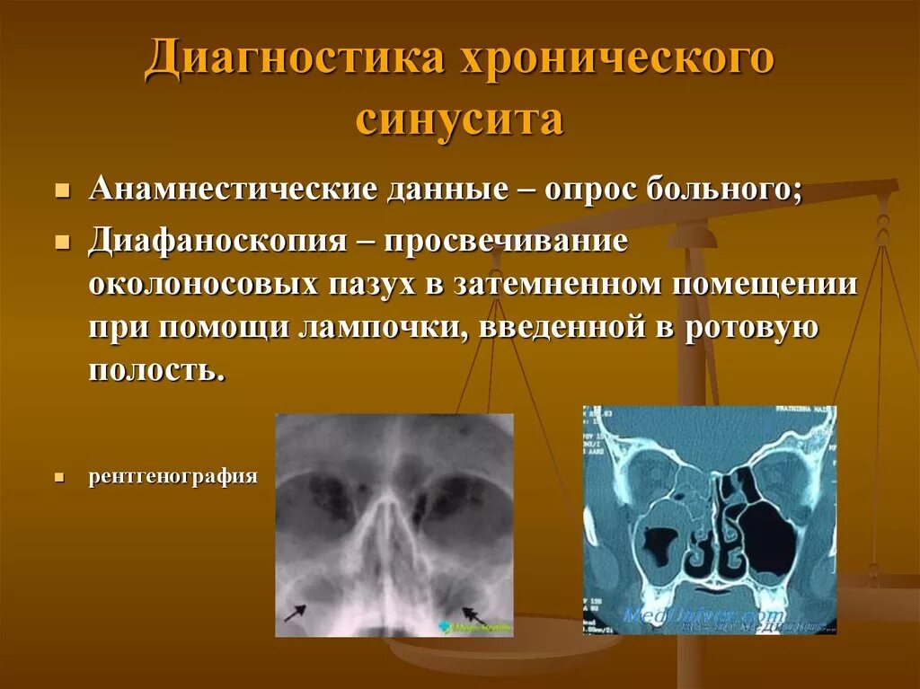 Хронический гайморит диагноз. Риносинусит острый риносинусит. Диагноз фронтит гайморит. Клиническая картина синусита. Гайморит симптомы чем лечить