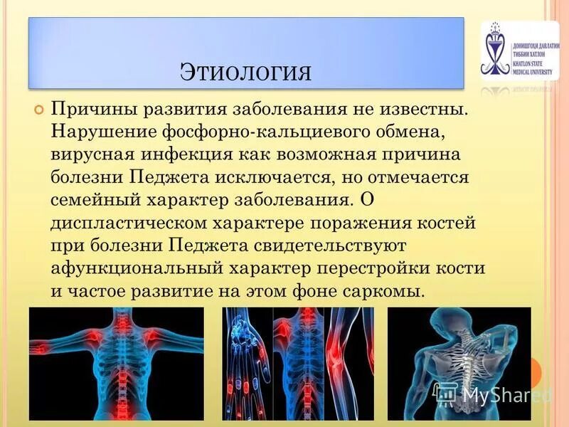 Лечение костных заболеваний. Заболевания костно-суставного аппарата. Заболевания костной системы человека. Заболевания связанные с нарушением фосфора.