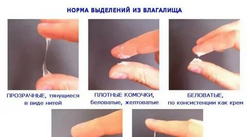 Сильные выделения перед месячными