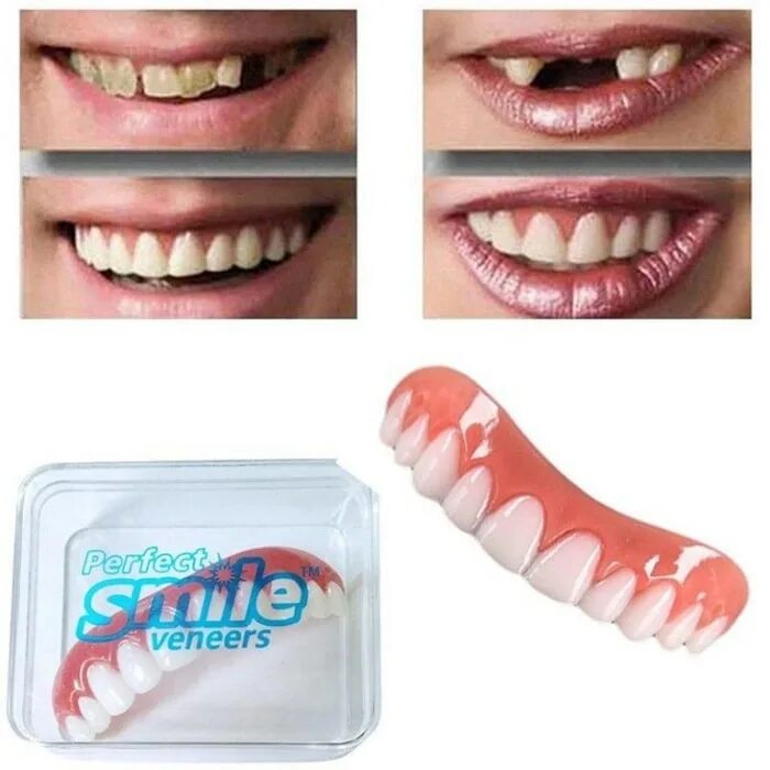 Виниры perfect smile Veneers. Накладные виниры perfect smile. Perfect smile Veneers накладные виниры. Перфект Смайл виниры.