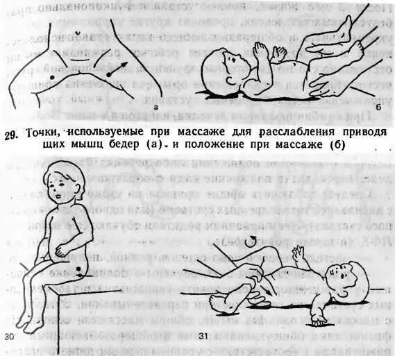 Можно делать массаж при температуре ребенку. Массаж при дисплазии тазобедренных суставов у детей 1 года. массаж новорожденному при дисплазии тазобедренных суставов. гимнастика при дисплазии тазобедренных суставов у грудничков 3. лфк при дисплазии тазобедренных суставов у грудничков 7 месяцев.