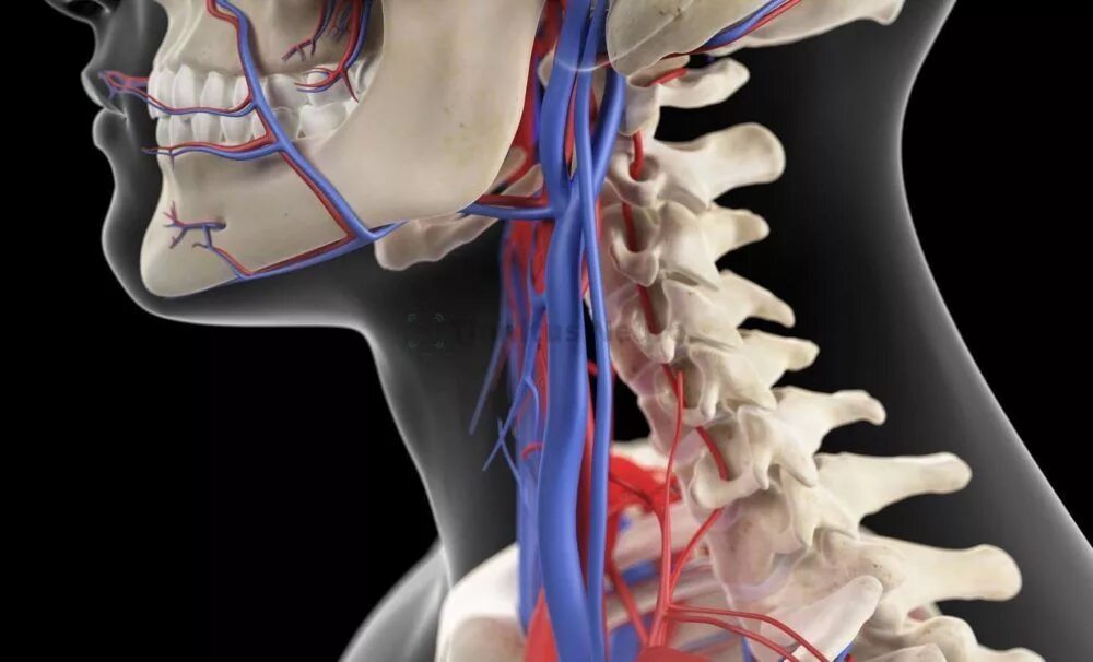 Остеохондроз шейный нерв. Синдром позвоночной артерии с4. Шейный синдром позвоночной артерии. Стеноз позвоночной артерии. Позвоночная артерия шейного отдела.