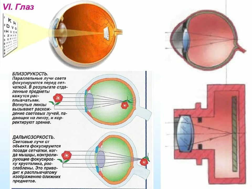 Фокусировка лучей света на внутренней поверхности. Близорукость лучи фокусируются. При близорукости лучи света фокусируются. Лучи света фокусируются перед сетчаткой. При близорукости лучи света фокусируются перед сетчаткой.