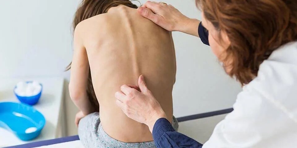 Сколиоз у ребенка какой врач. Болит спина. врач который искривление позвоночника. диагностика сколиотической деформации позвоночника.