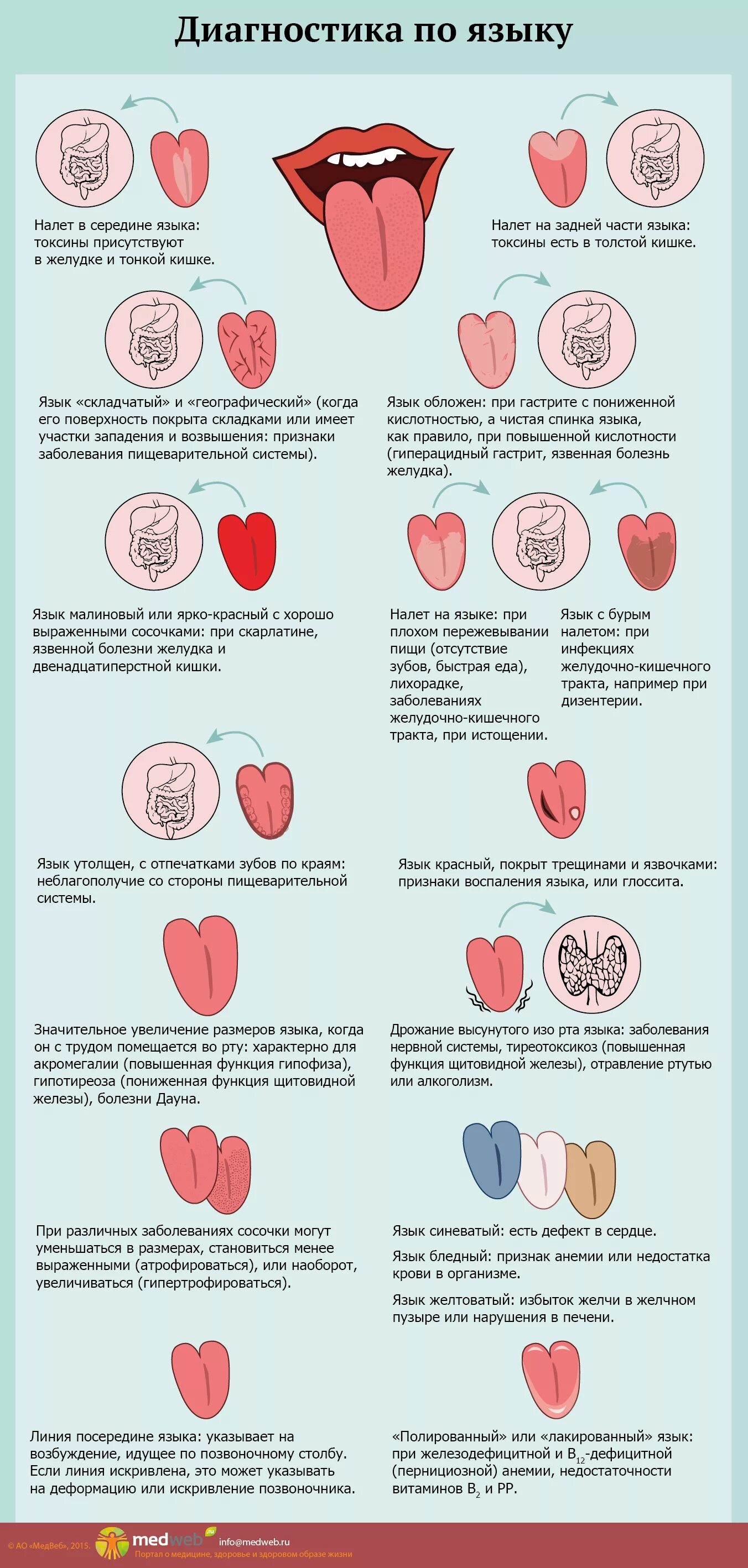 Болезни по языку определить. Выявление болезней по цвету языками. Какой размер языка