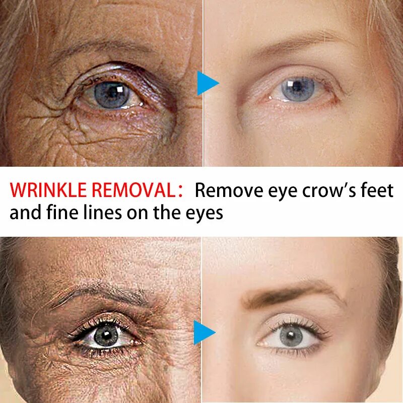 крем для век с гиалуроновой кислотой hyaluronic eye cream 40 мл. Ekel крем для глаз с гиалуроновой кислотой hyaluronic acid eye cream\. [ekel] крем для век гиалуроновая кислота hyaluronic acid intensive eye cream, 40 мл. крем для глаз - hyaluronic eye cream [3w clinic]. гиалуроновая кислота для кожи вокруг глаз.