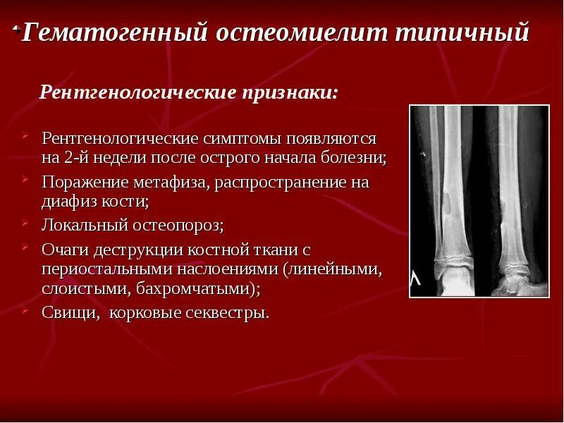 Заболевание костей и суставов название
