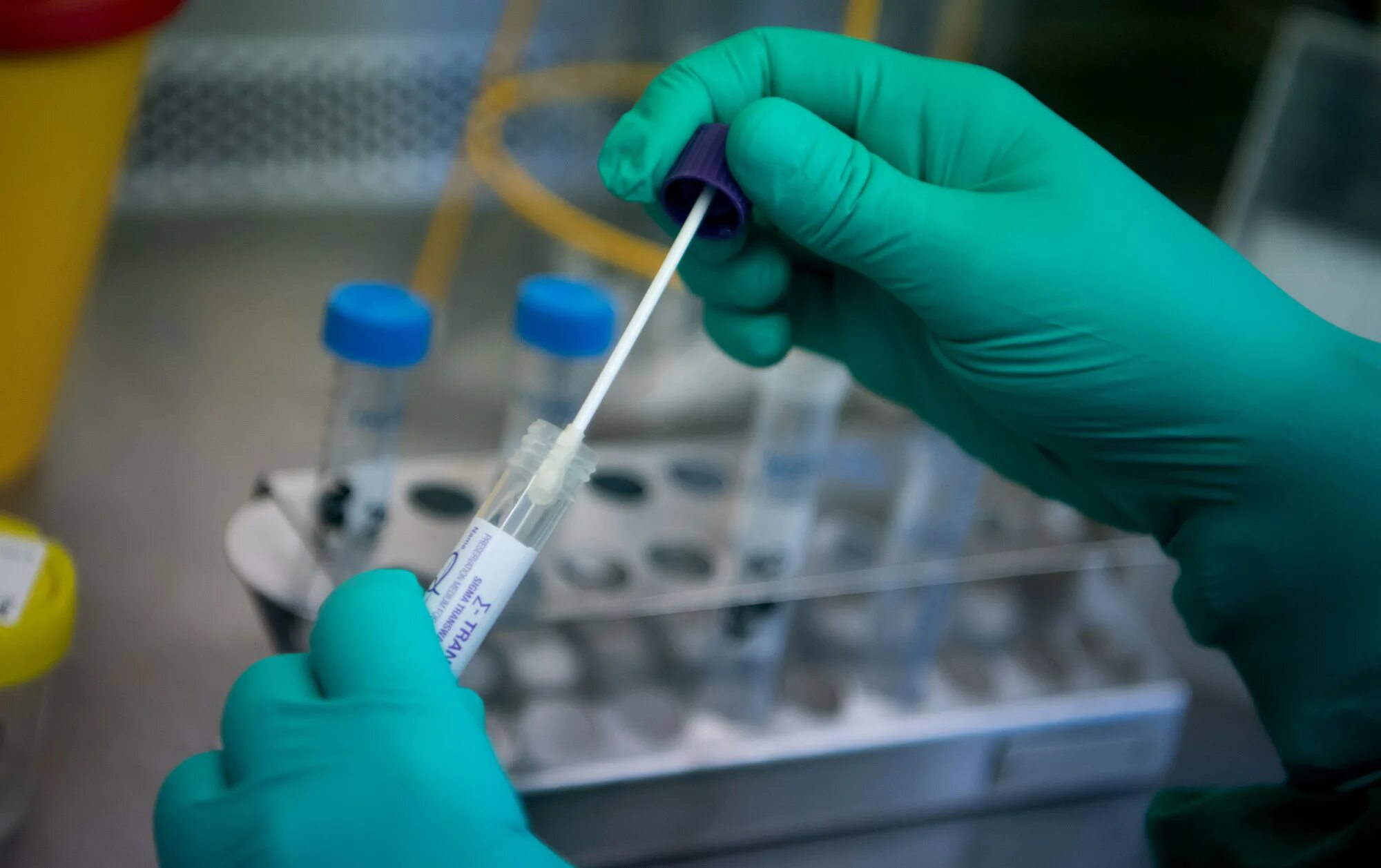 Virus testing