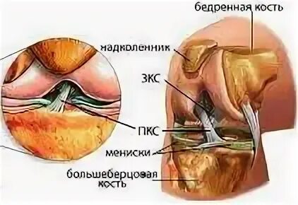 Дегенеративные изменения связок