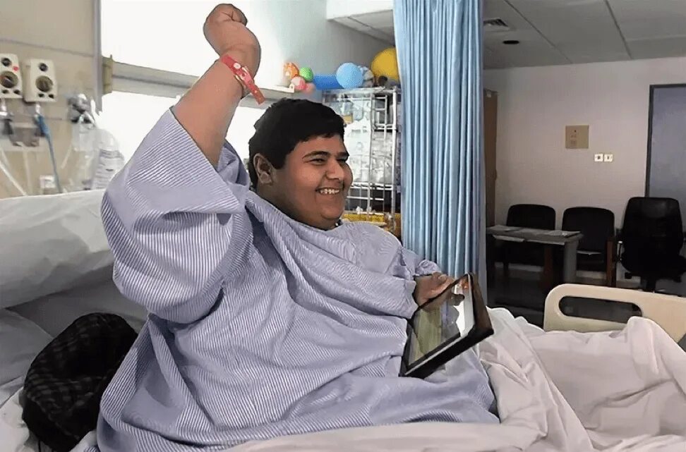 орофарингеальный кандидоз. пухлый язык. пухлый язык. гипертрофический глоссит. пухлый язык.