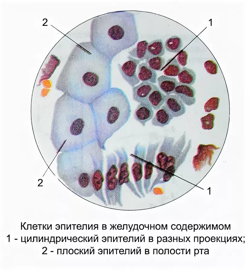 Цилиндрический эпителий микроскопия кала. Эпителий в желчи микроскопия. Микроскопия желудочного содержимого. Микроскопическое исследование желудочного содержимого.