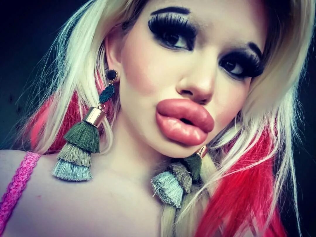 Утиные губы у девушек. Утиные губы у девушек. Губошлепка кайли. Утиные губки девушек. Красивые губки девушек.