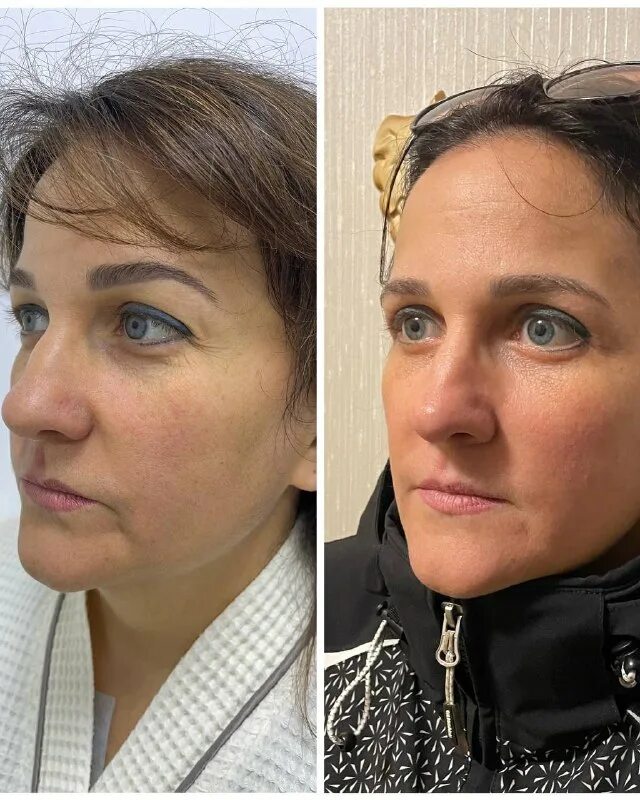 Окушко ситора самировна отзывы. Окушко ситора самировна. Косметолог ситора самировна. Окушко ситора самировна. Окушко алёна владимировна.