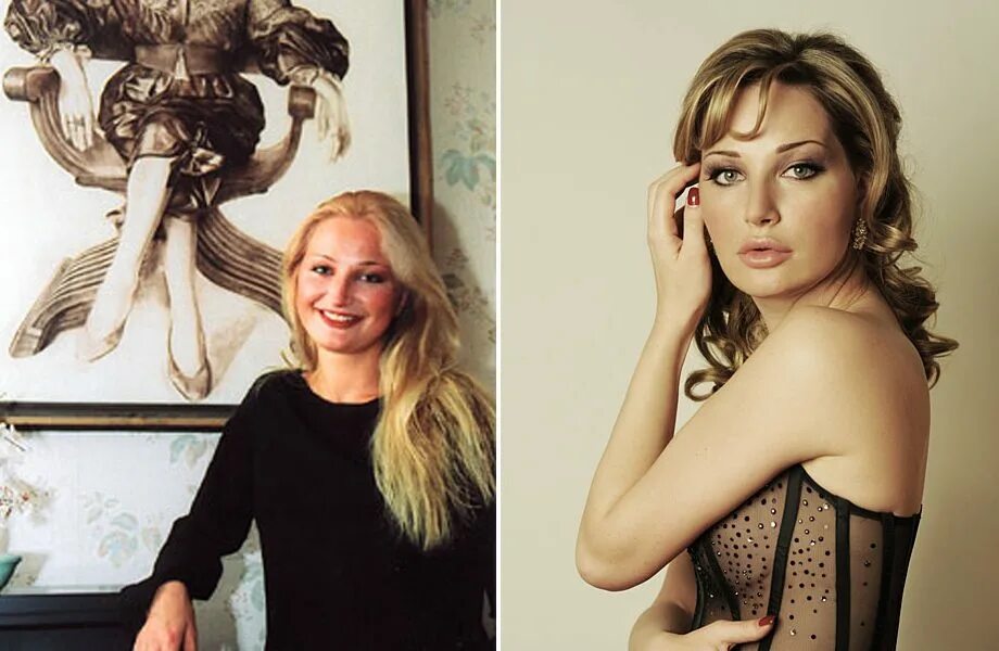 Мария максакова до пластической операции. Мария максакова до пластики. Максакова после пластики. Мария максакова до пластики фото. Максакова после пластики.