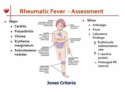 Polyarthritis латынь