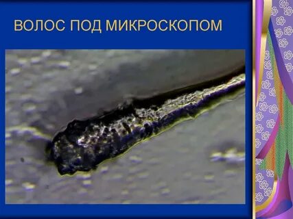 Волос под