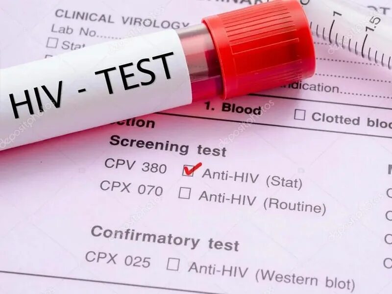 Скрининг ВИЧ инфекции. Скрининговые тесты на ВИЧ. Скрининговый тест ИФА на ВИЧ. Скрининг метод при ВИЧ.