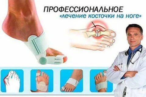 Лечение косточки без операции