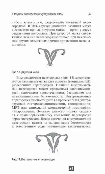 Что такое двурогая матка. Двурогая матка. Внутриматочная перегородка.. Двурогая матка на УЗИ описание. Внутриматочная спираль при двурогой матке.