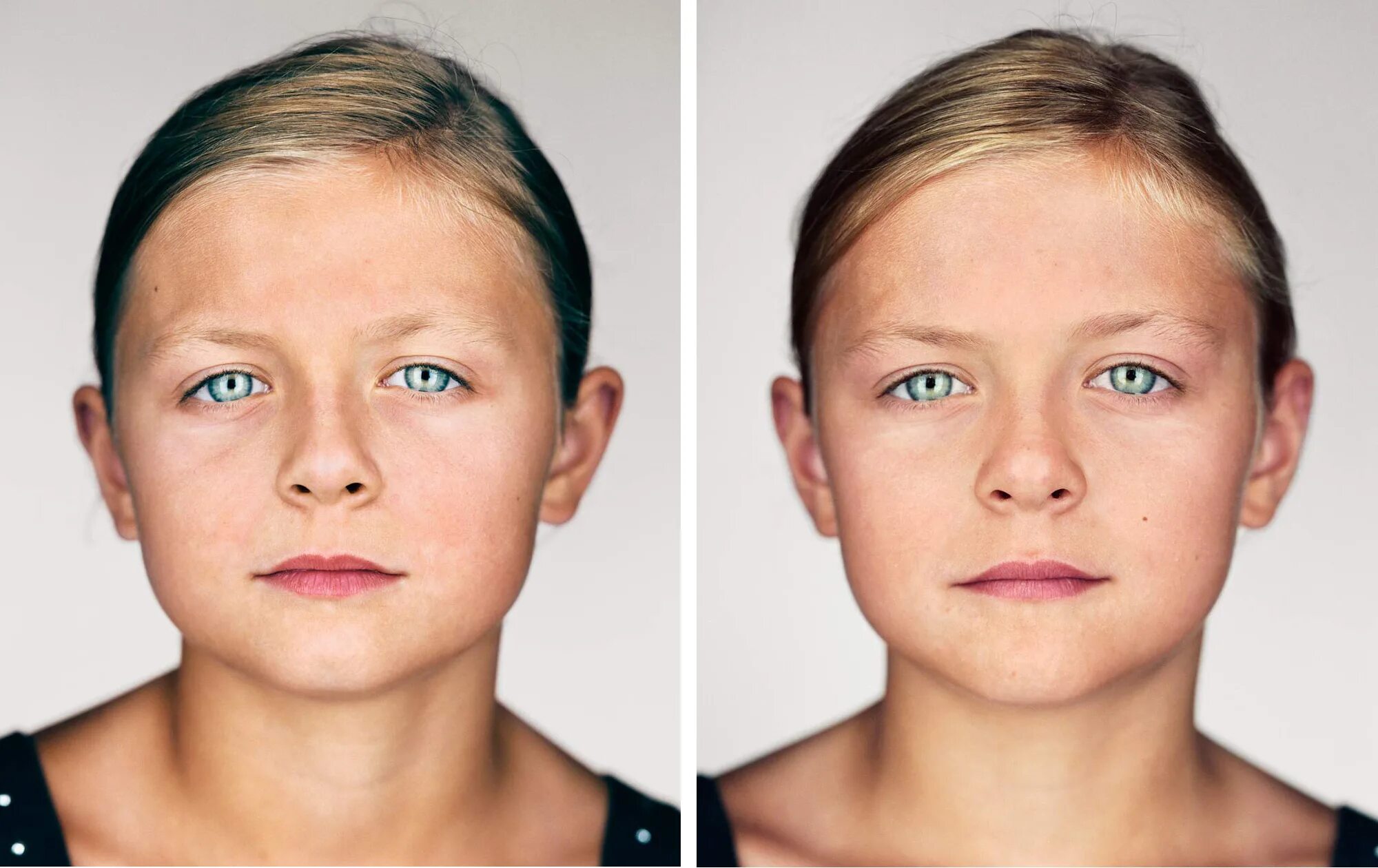 Насколько схожи. Детское лицо у взрослого. Два разных лица. Асимметрия лица. Не доразвитые лерты лица.