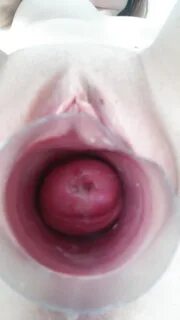 My cervix - Photo #3.