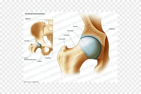 Форма тазобедренного сустава