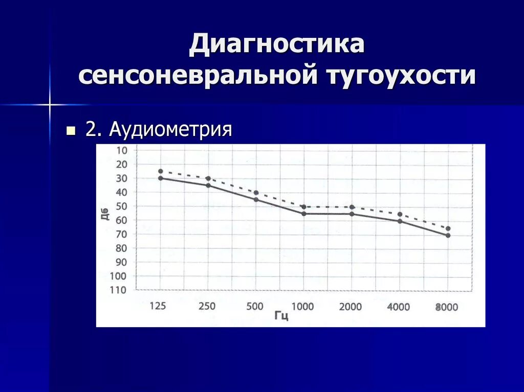 Подострая тугоухость. Подострая тугоухость