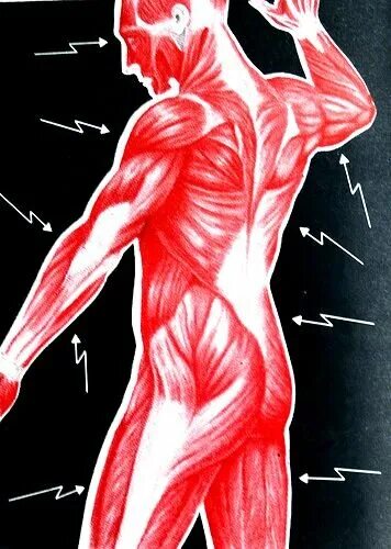 Воспаление скелетных мышц – миозит;. Перенапряжение мышц. Мышечная усталость.