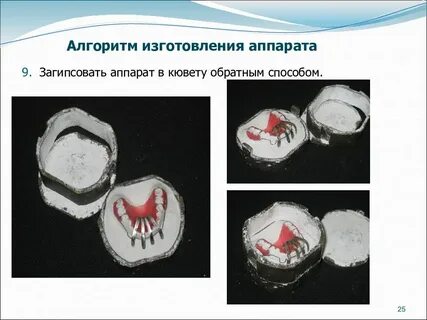 Гипсовка в кювету