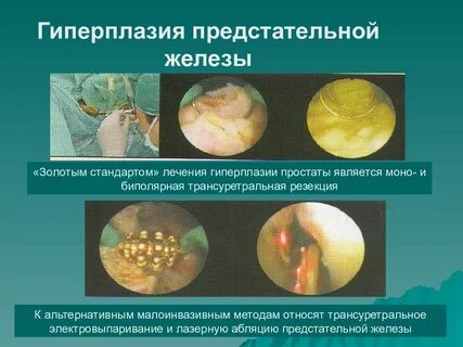 Гпж урологии