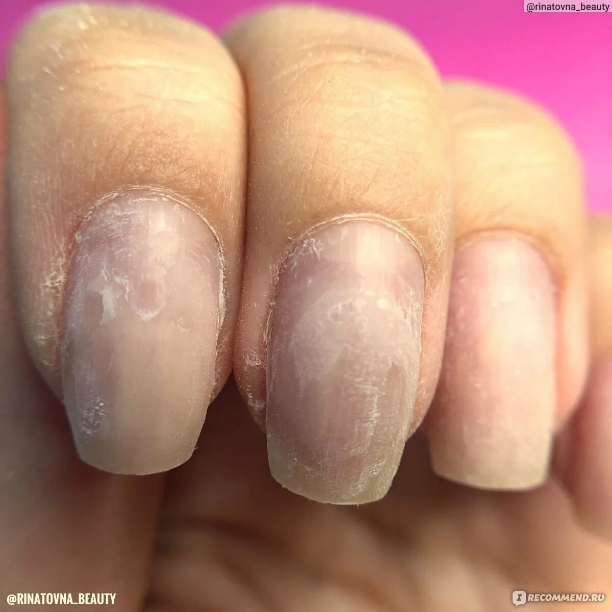 Пропилы на ногтях после аппаратного маникюра. Пропилы на ногтях после аппаратного маникюра. Пропилы у кутикулы. Пропилы у кутикулы. Пропиленные ногти фрезой.