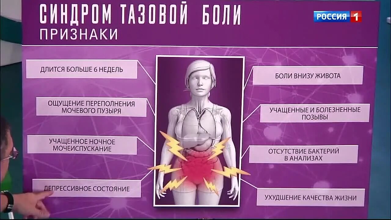 Синдром хронической тазовой боли. Синдром хронической тазовой боли (схтб). Синдром хронической тазовой боли. Тазовый болевой синдром. Хронический тазовый болевой синдром.