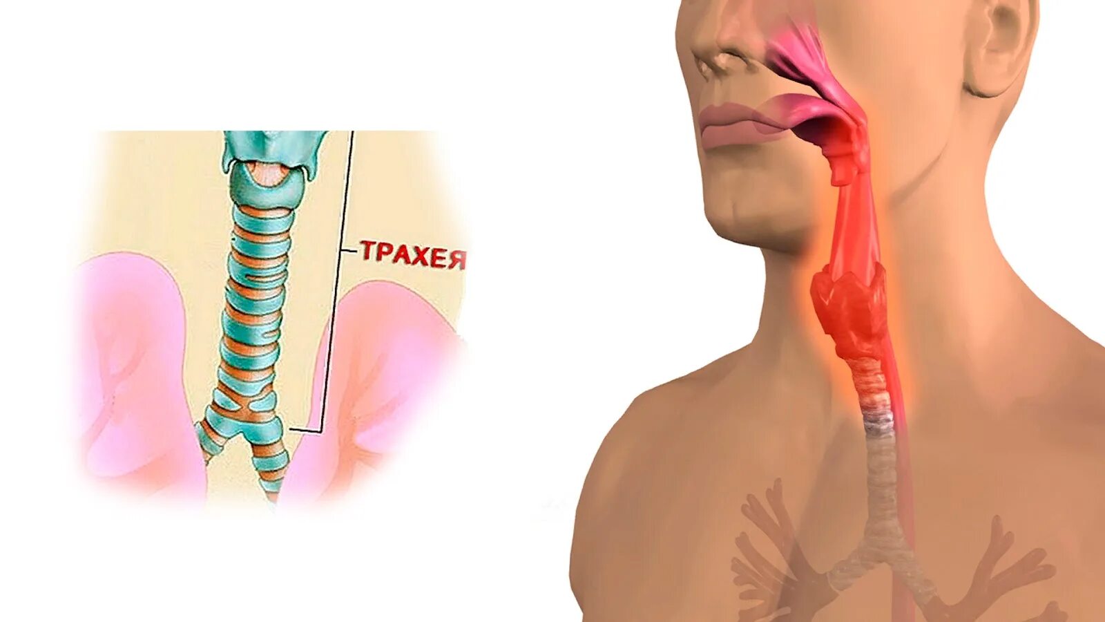 Болит горло пищевод. Трахея. Ттрахеч. Трахея человека.