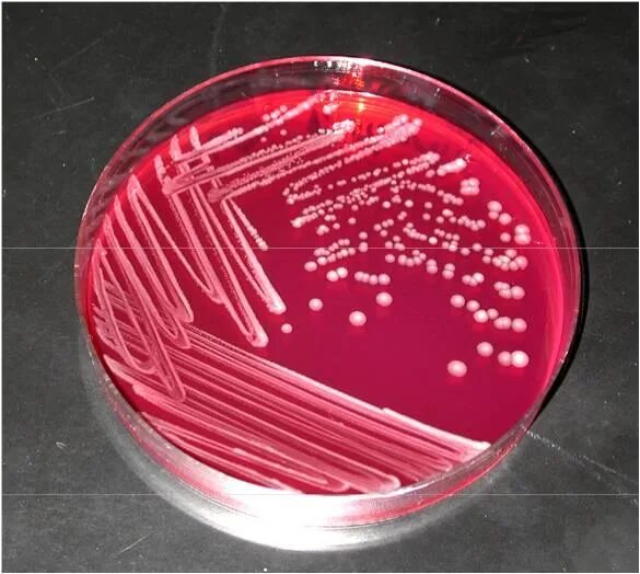 Spp salmonella spp shigella spp. Агар xld shigella. сальмонелла на xld агаре. сальмонеллы на агаре плоскирева. сальмонеллы на среде плоскирева.