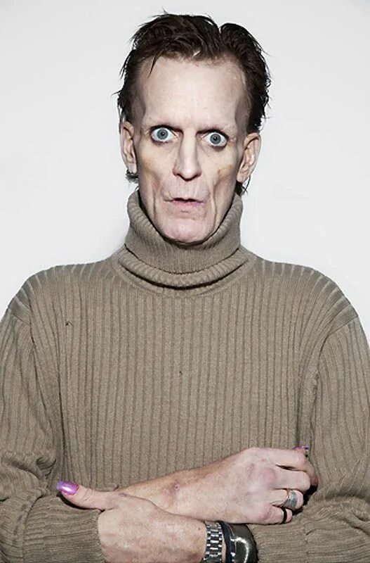 Лицо парня. Лицо худого человека. Лицо худого человека. Лицо худого человека. Длинная шея у мужчин.