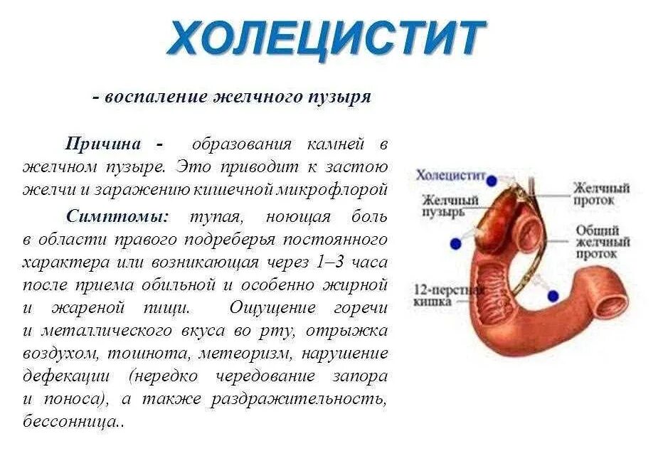 Жжение после опорожнения. Холецистит воспаление желчного пузыря.