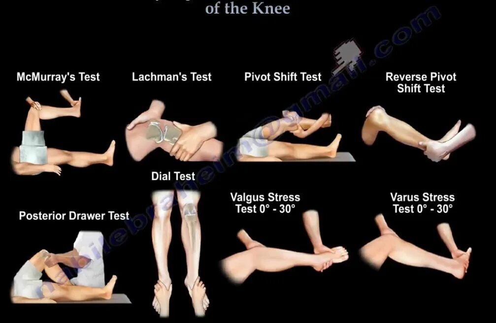 Вальгус Варус стресс тест. Тесты на коленный сустав