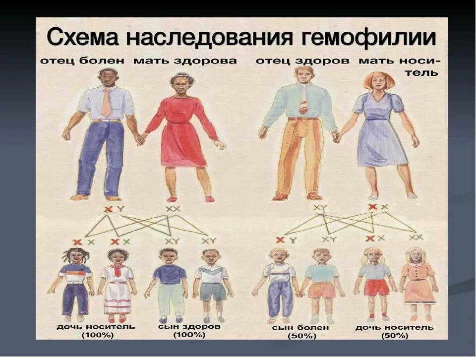 Дети больные гемофилией. Тип наследования болезни гемофилии. Тип наследования при гемофилии. Гемофилия наследование генотипы. Схема наследования гемофилии у человека.