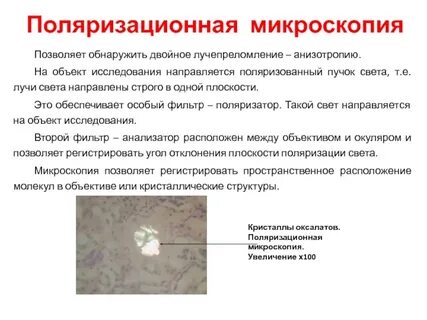 Метод микроскопии позволяющий изучать вирусы