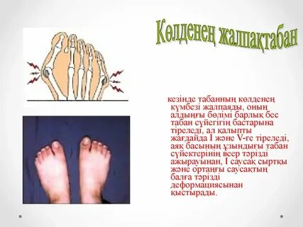 Аяқ фетиші: аяқтың көтерілген фотосы