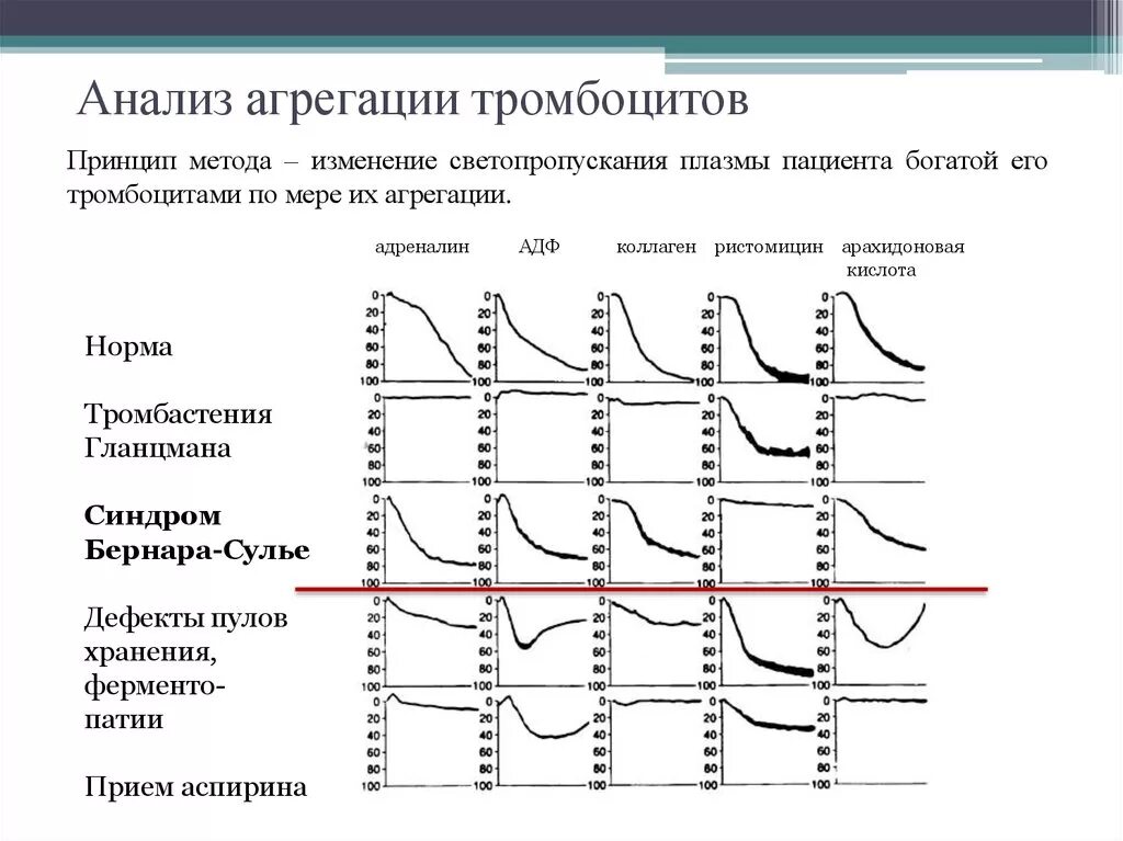 Коллаген агрегация. Исследование коллаген-индуцированной агрегации тромбоцитов. Исследование агрегационной функции тромбоцитов. Агрегация тромбоцитов с адреналином норма. Агрегация тромбоцитов с АДФ.