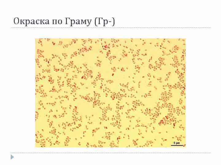 Грамположительные и грамотрицательные бактерии таблица. Классификация по граму. Классификация грамотрицательных кокков. Классификация по граму. Клеточная стенка грамположительных бактерий микробиология.