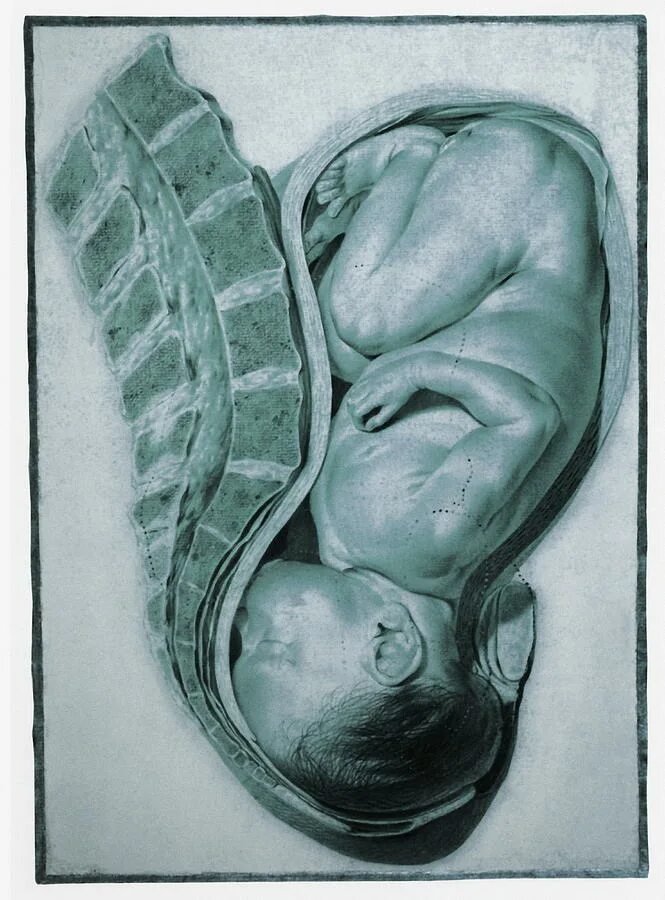 как лежит ребенок на 38. как лежит ребенок на 38. малыш в утробе 38 недель. как лежит ребенок на 38. эмбрион 36 недель беременности.