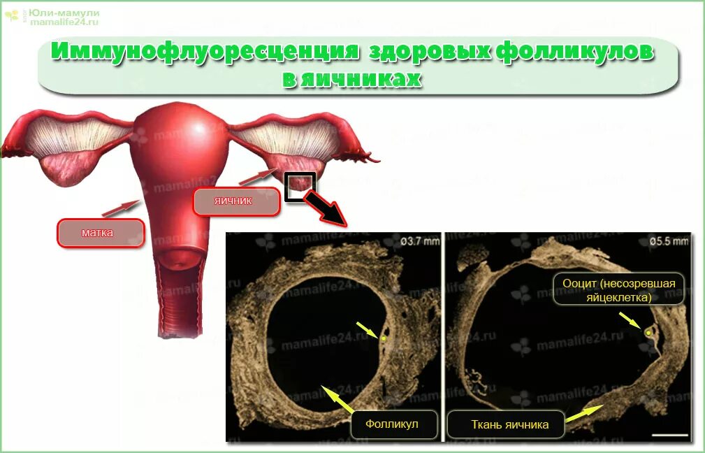 норма фолликул в яичниках у женщин.
