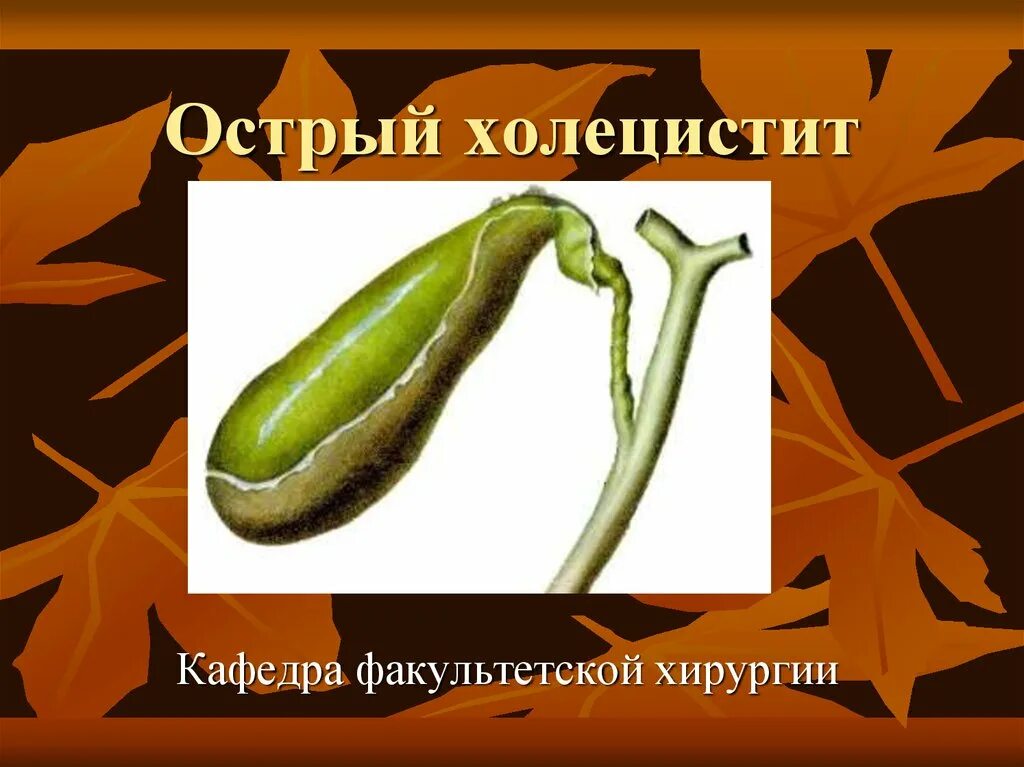 Острый холецистит хирургические. Острый холецистит Факультетская хирургия. Острый холецистит презентация.