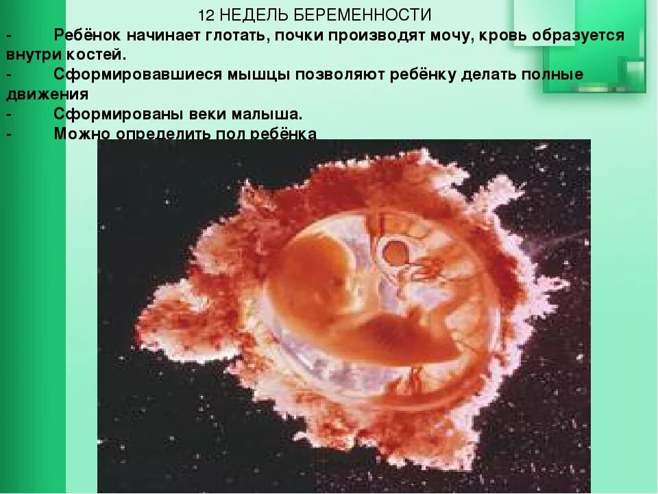 12 недель читать. 12 Недель беременности. Плод на 12 неделе беременности. Размер ребенка на 12 неделе. Размер зародыша в 12 недель.