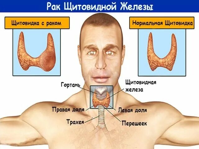 Щитовидная железа у мужчин. Расположение щитовидной железы у мужчин. Где находится щитовидная железа.