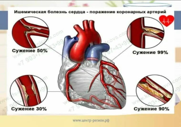 Что делать если колоть сердце